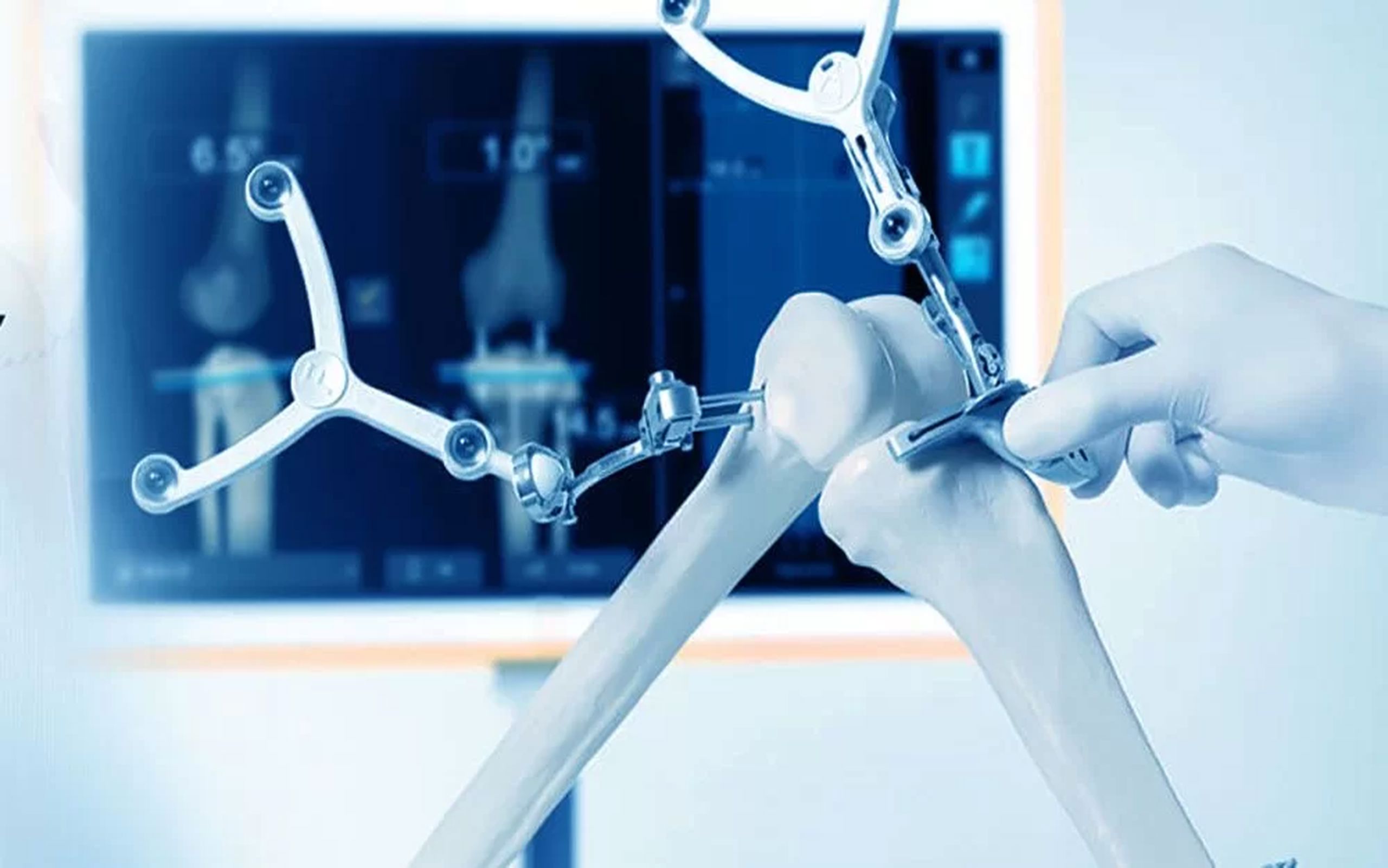 robotik diz protezi ameliyati